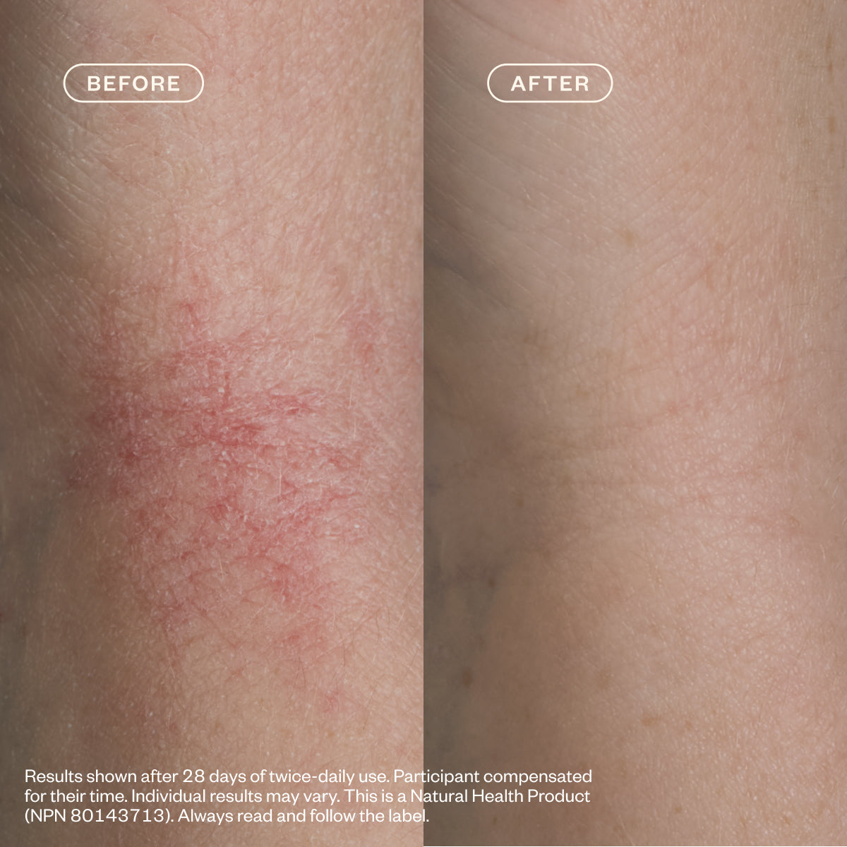 Dermedial™ Relief Duo